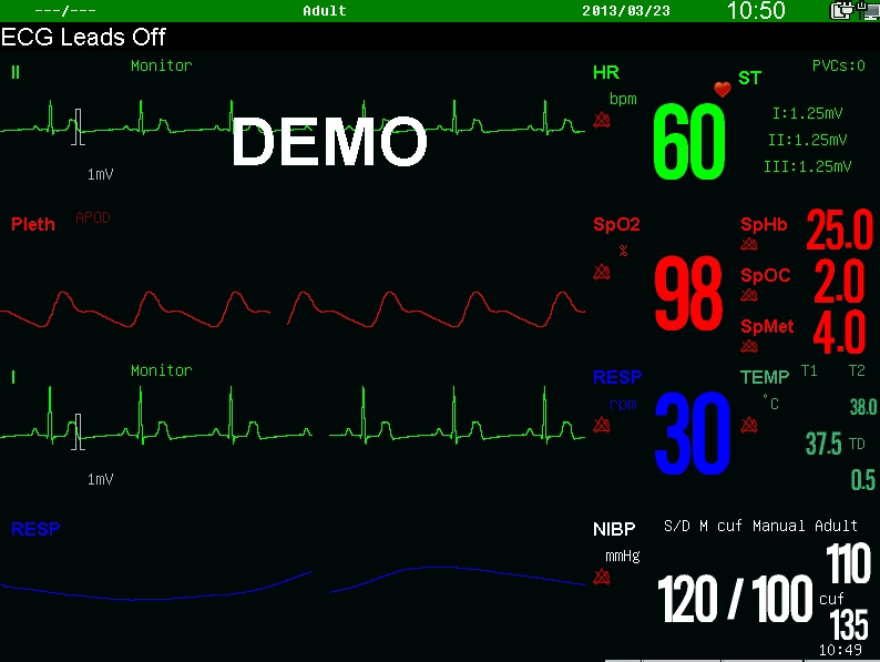 Sinnor Snp9000n Medical Equipment Pulse Oximeter Patient Monitor Bedside OEM /ODM