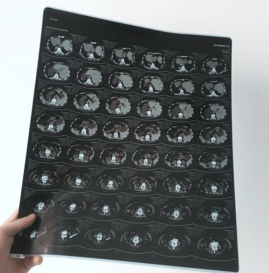Good Quality Medical Disposables Dry Inkjet Film Medical Paper for Hospital