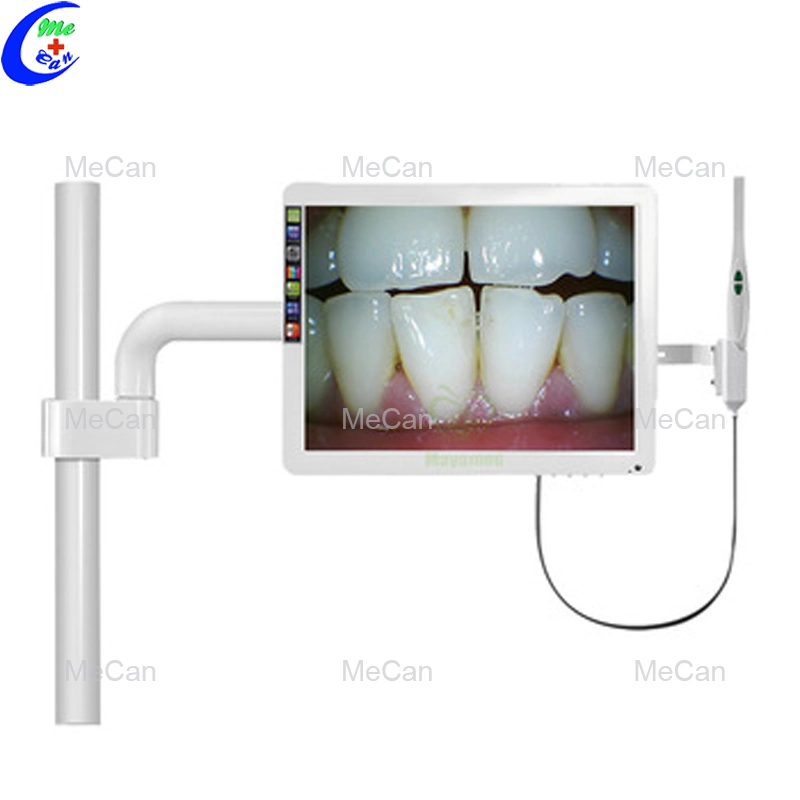 Oral Endoscope All-in-One Standard Dental Endoscope Medical Endoscope