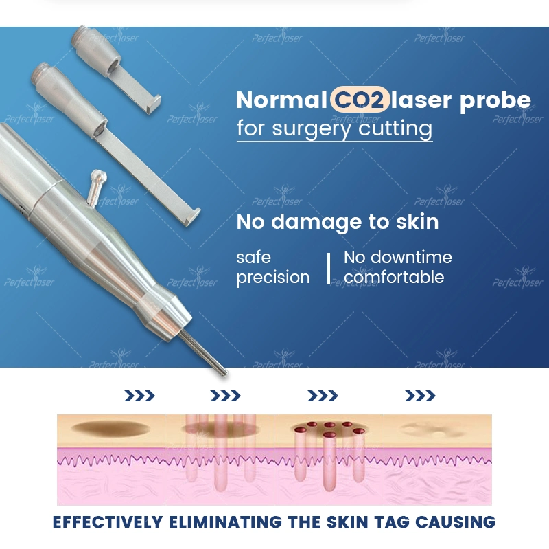 Élimination verticale des marques de déformation traitement du pigment machine laser à CO2 fort