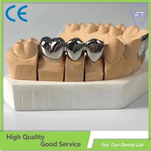 Dental Metal Ceramic Crown Dental Implant Customized