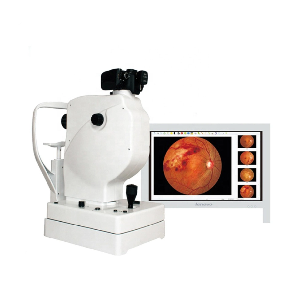 Ophthalmic Best Sale Non-Mydriatic Sk-650A Digital Fundus Camera