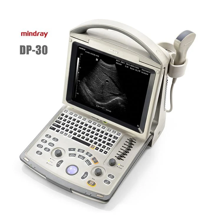 Mindray DP-30 4D Ultrasound portátil Doppler escáner de ultrasonidos