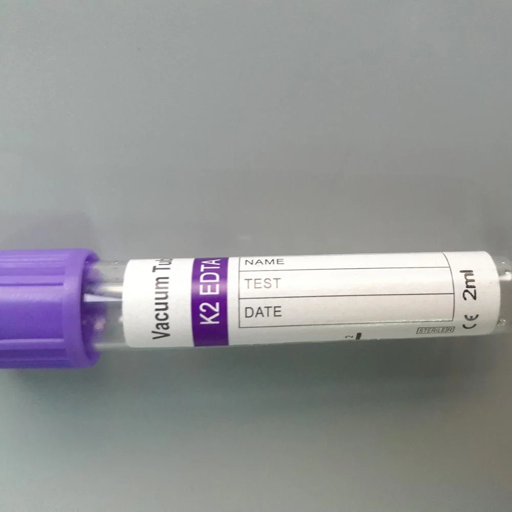 Medical Vacuum Pet/Glass Sodium EDTA Vacuum Blood Collection Tube