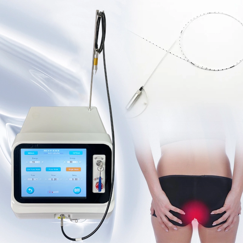 New 980 1470nm Proctology Surgical Laser Hemorrhoid Treatment Diode Laser Medical Device