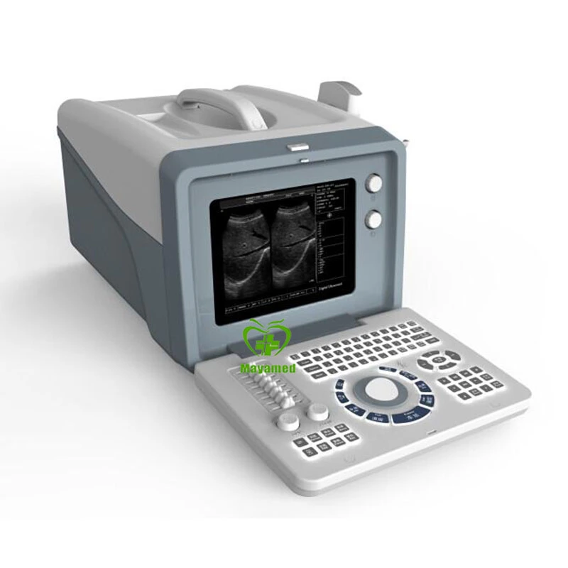 Meu-A001um instrumento Médico Scanner portátil equipamentos de diagnóstico do sistema de ultra-som