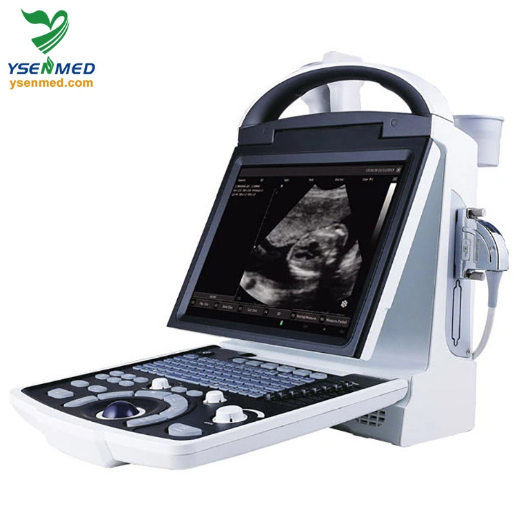 Medical Ysb5533 Portable B/W Ultrasound Machine Medical Equipment