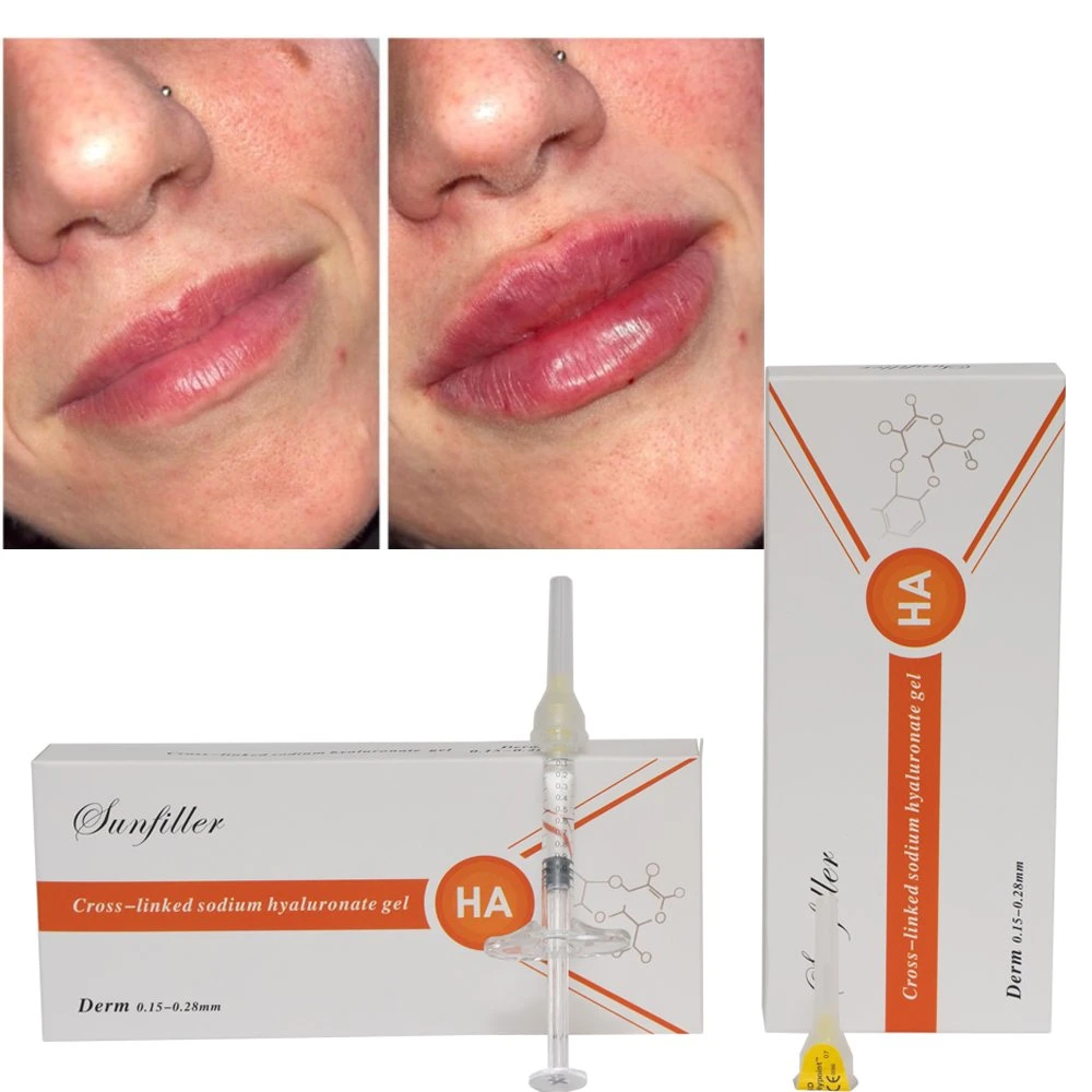 to Buy Lower Price Facial Lip Fillers Injections Filler Hyaluronic Acid Injectable Dermal Filler