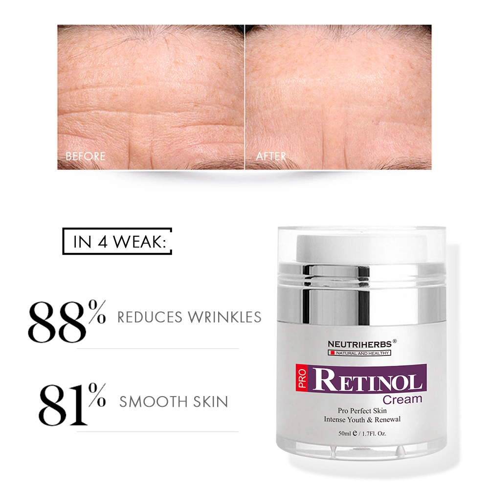 Cosmetic Skincare Beauty Products Anti Wrinkle Anti Aging Face Retinol Cream