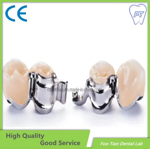 High quality/High cost performance  Removable Denture Cast Partial Framework Dental Customized