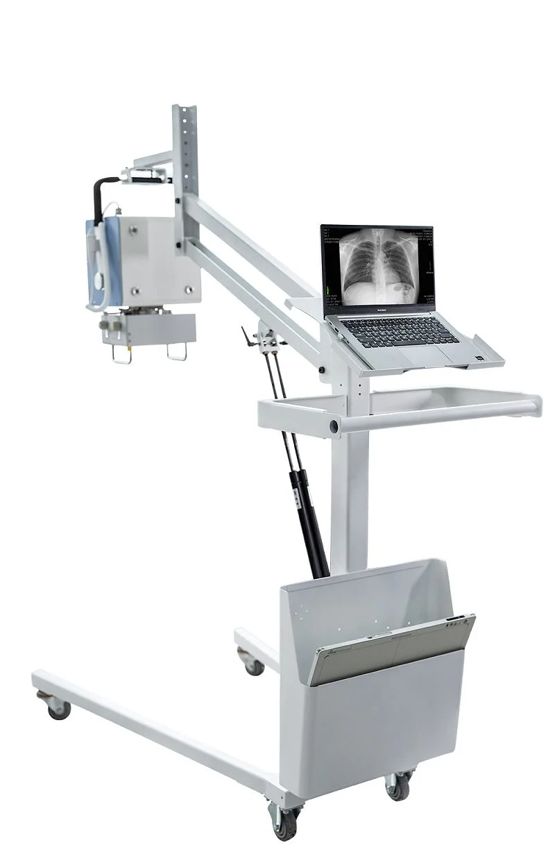 Médico portátil Veterinario Digital X Ray móvil barato X Ray