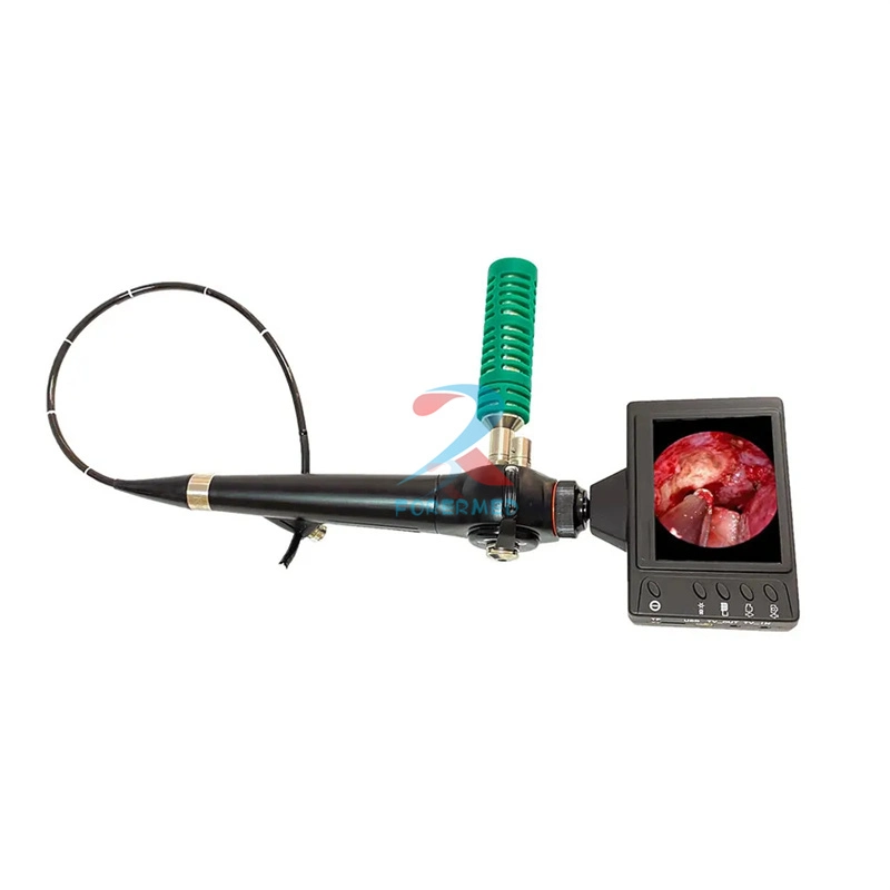 Advanced Video Laryngoscopy Medical Price Real-Time Recording Laryngoscopy