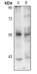 Pink1 (Phospho S402) Polyclonal Antibody