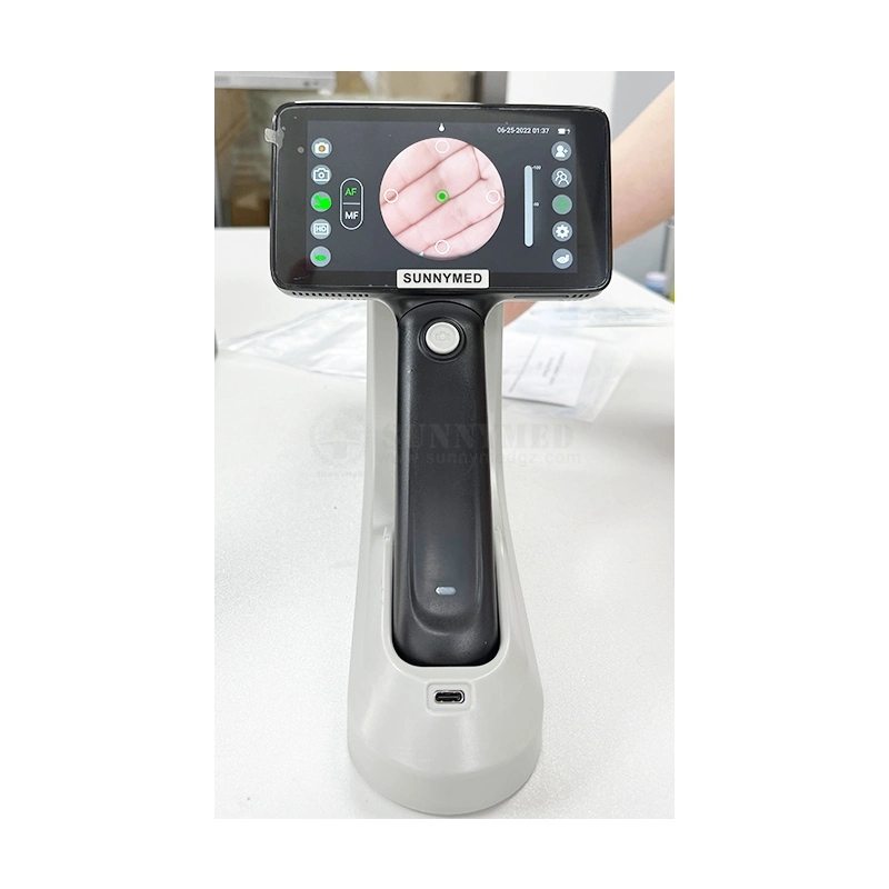 Sy-V042A Ophthalmic Instrument Auto Digital Reticam Handheld Fundus Camera