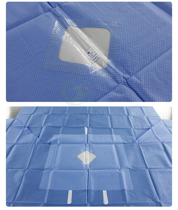 Medical Disposable SMS Sterile Surgical Drape for Surgery
