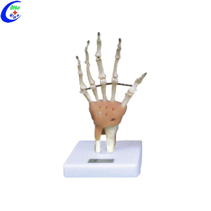 Shoulder Joint Model with Ligaments for Teaching