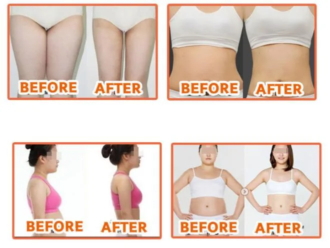 Hot Selling Korea Original Lipo Lab Slimming Injection V Line Lipolysis Injection Ppc Face Body Fat Dissolve