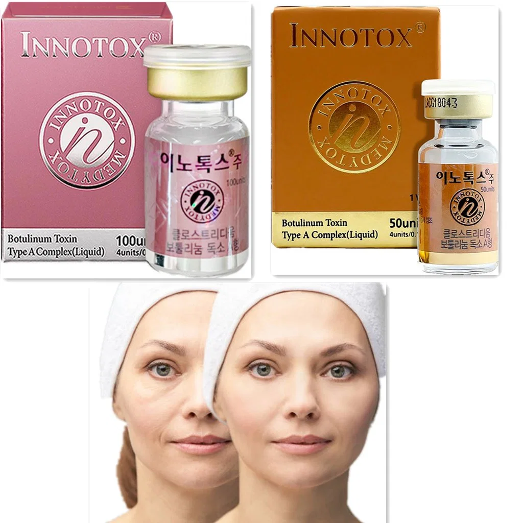 سعر الجملة كوريا مباشرة الشحن Inotox 50u 100u مضادة Wrinkle سائل بو تولينيكا نوع حقن حمض هيالورونيك ليز تو