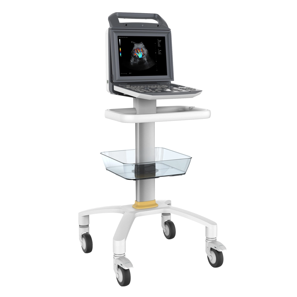 Портативный медицинский портативный компьютер 3D 4D Ultrasonic Ecografo Color Doppler Cardiac Ультразвуковая система