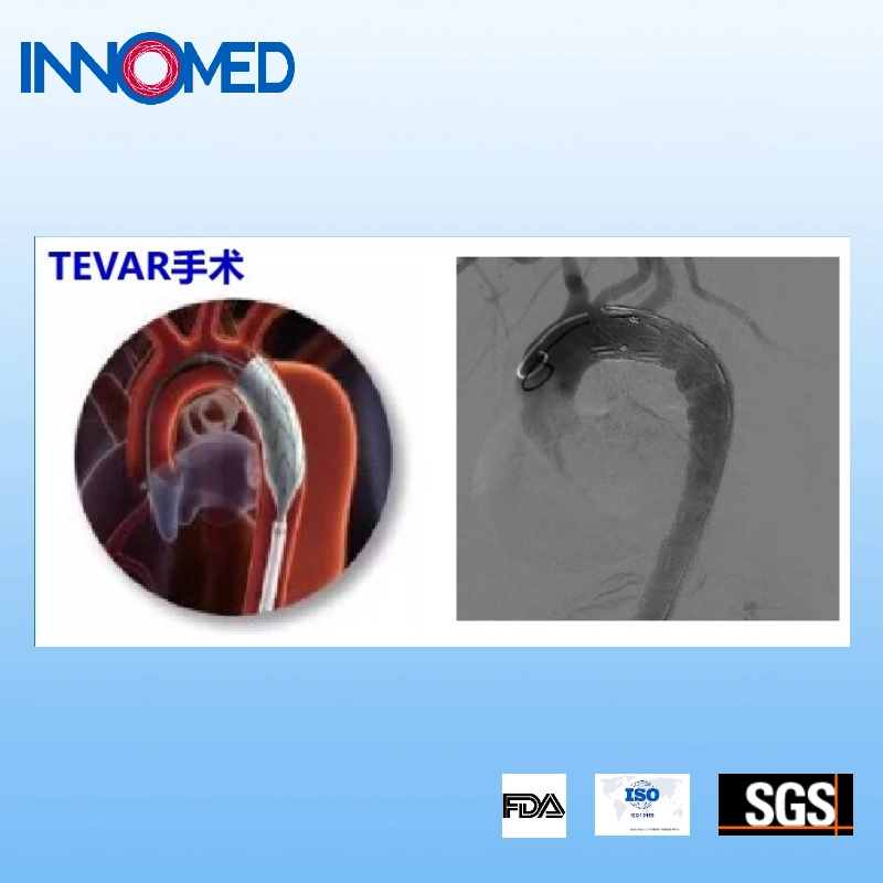 Inno Tavi-Wire Intravascular Guidewires for Surgery