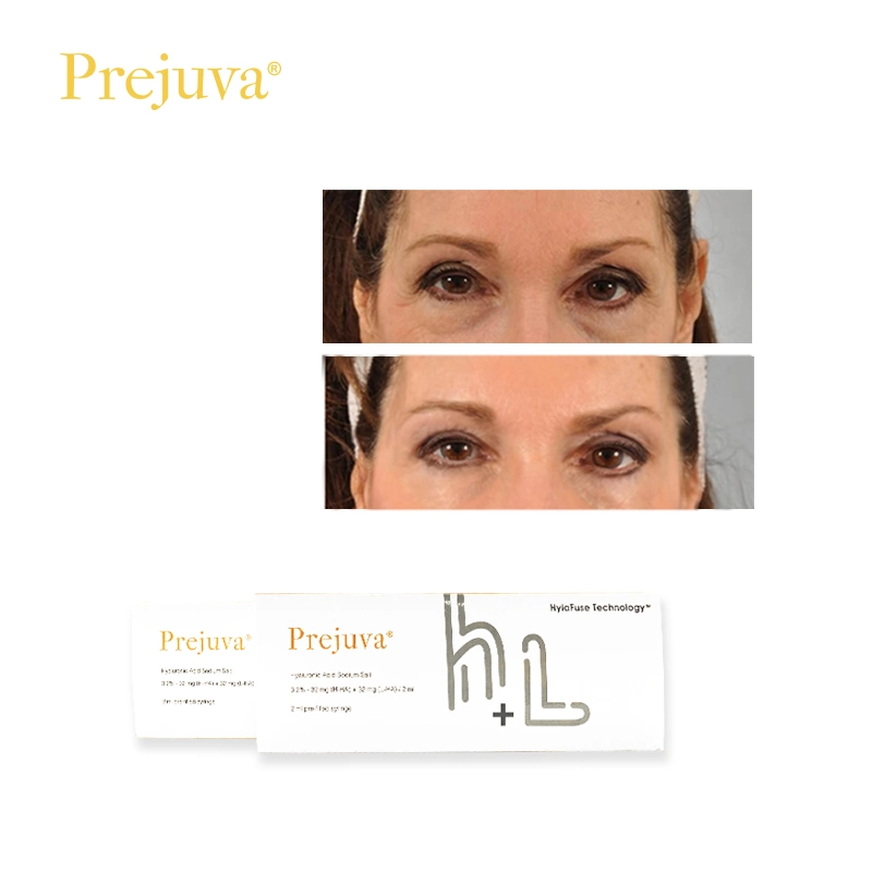 Prejuva Profhilo Solution injectable de rappel de la peau 3 2 64 mg 2ml Fille de la peau de remplissage Derma Booster