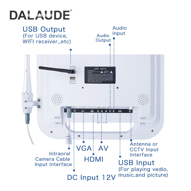 Mégapixels caméra dentaire clinique de l'endoscope Intraoral moniteur HD