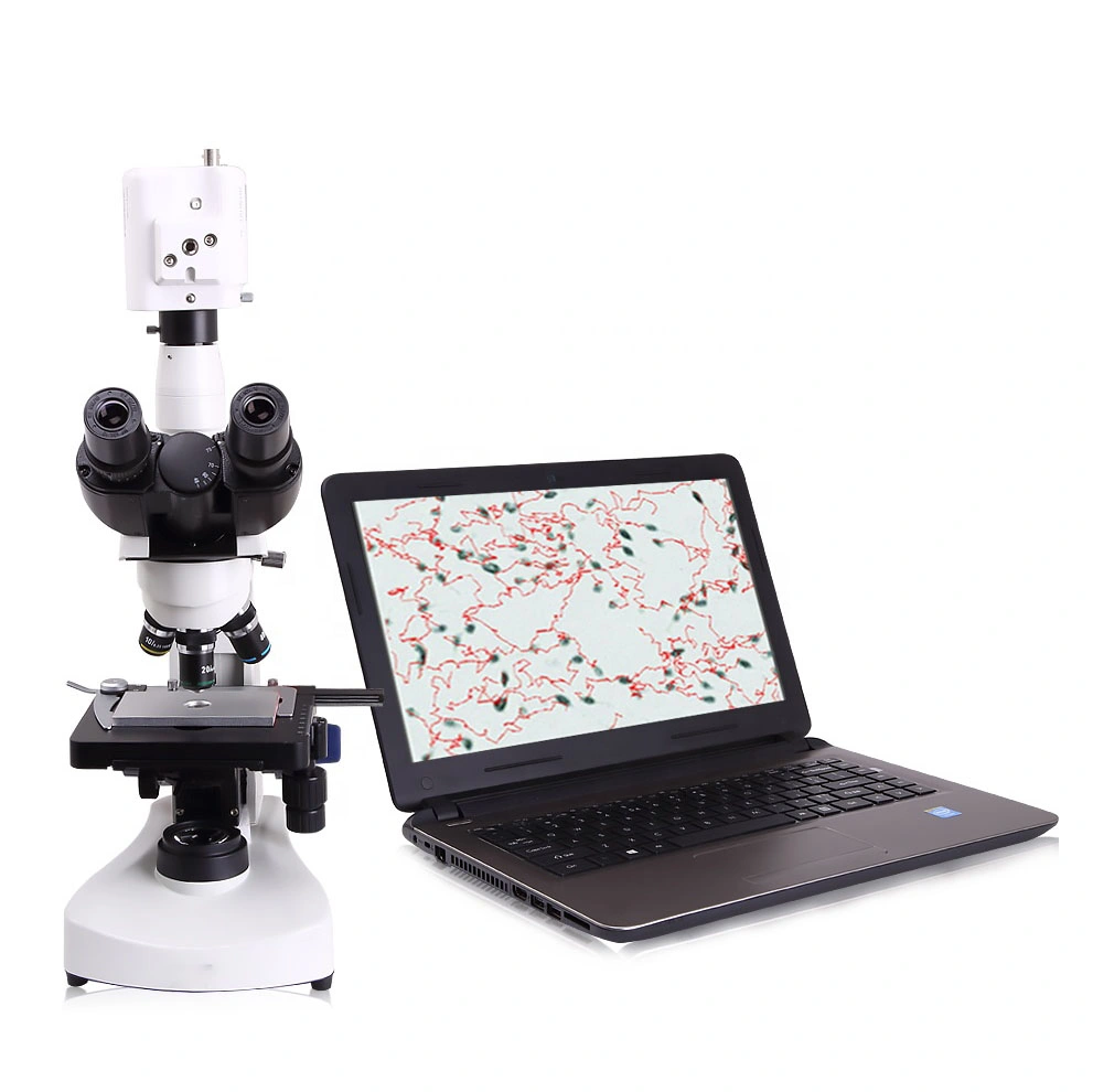 Wsa-10 Portable Microscope de sperme animal vétérinaires automatique de l'analyseur d'analyse de sperme