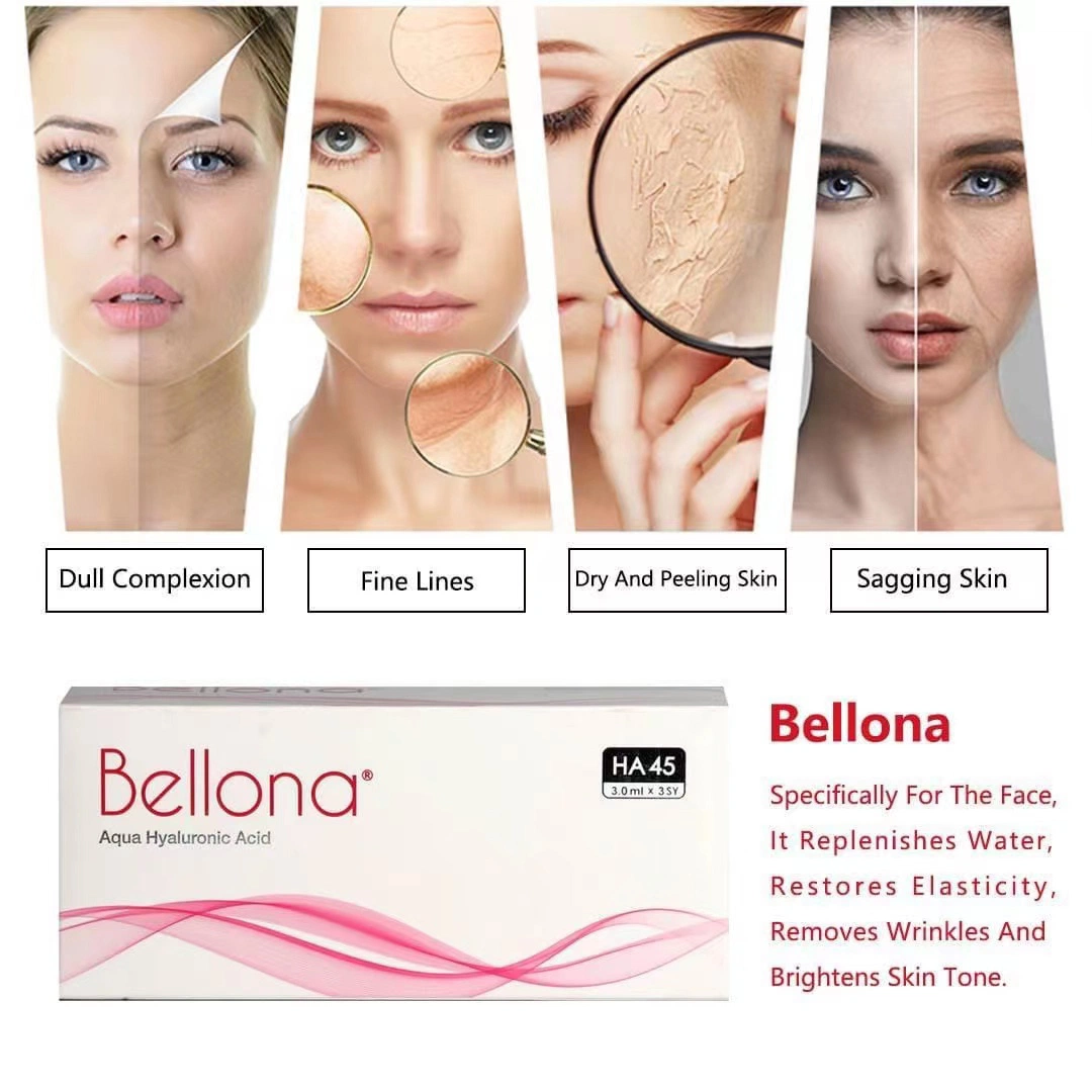 2022 Nuevo producto de levantamiento facial Bellona PCL 3ml de ácido hialurónico líquido Bellona para iluminar la inyección de llenado de ha.