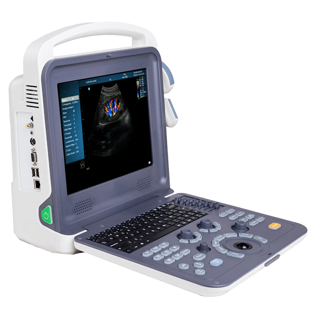 Usine Prix de gros Full Digital portable Doppler couleur échographie diagnostic Système