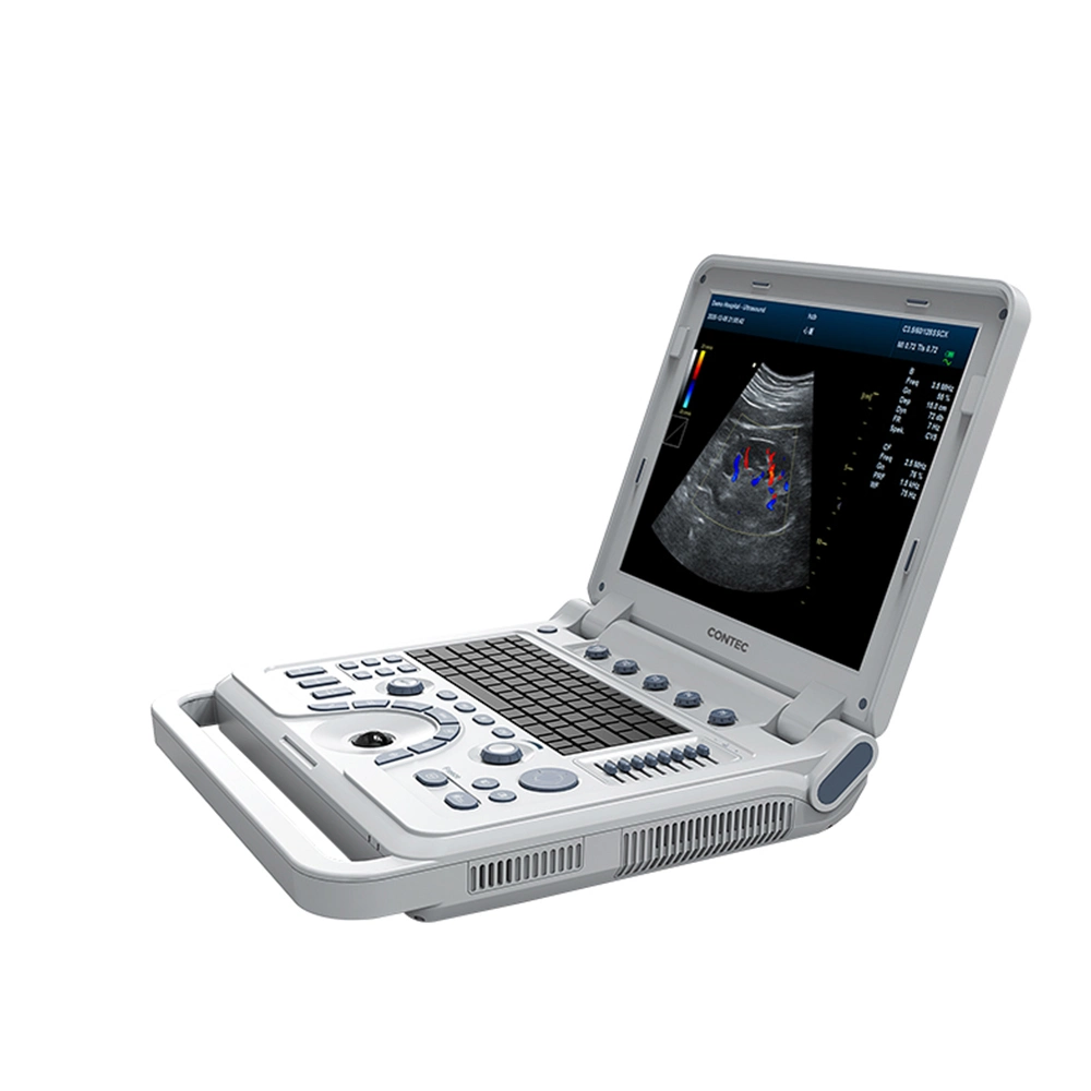 Contec Cms1700b-Vet Veterinary Ultrasound Equipment Dog Pet Ultrasound Machine