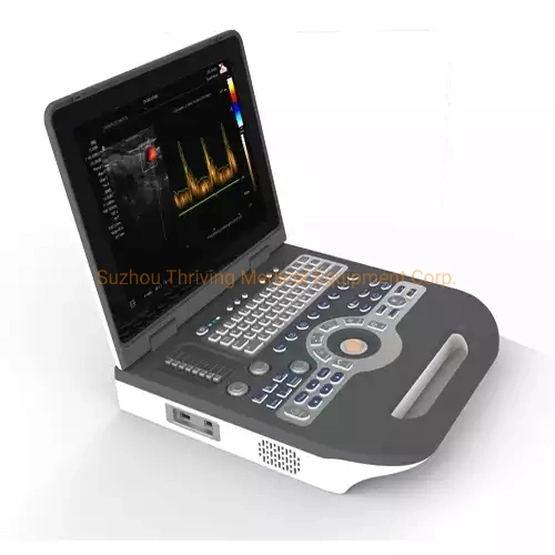 Medical Diagnostic Equipment Full Digital Portable Ultrasound Device for Hospital and Clinic