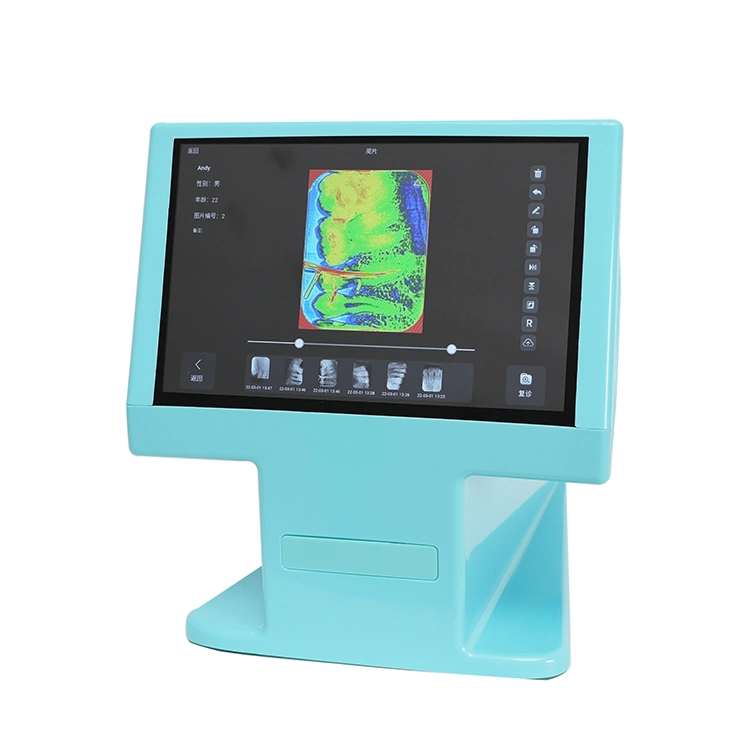 Dentist Equipment Phosphor Plate Reader with Touch Screen