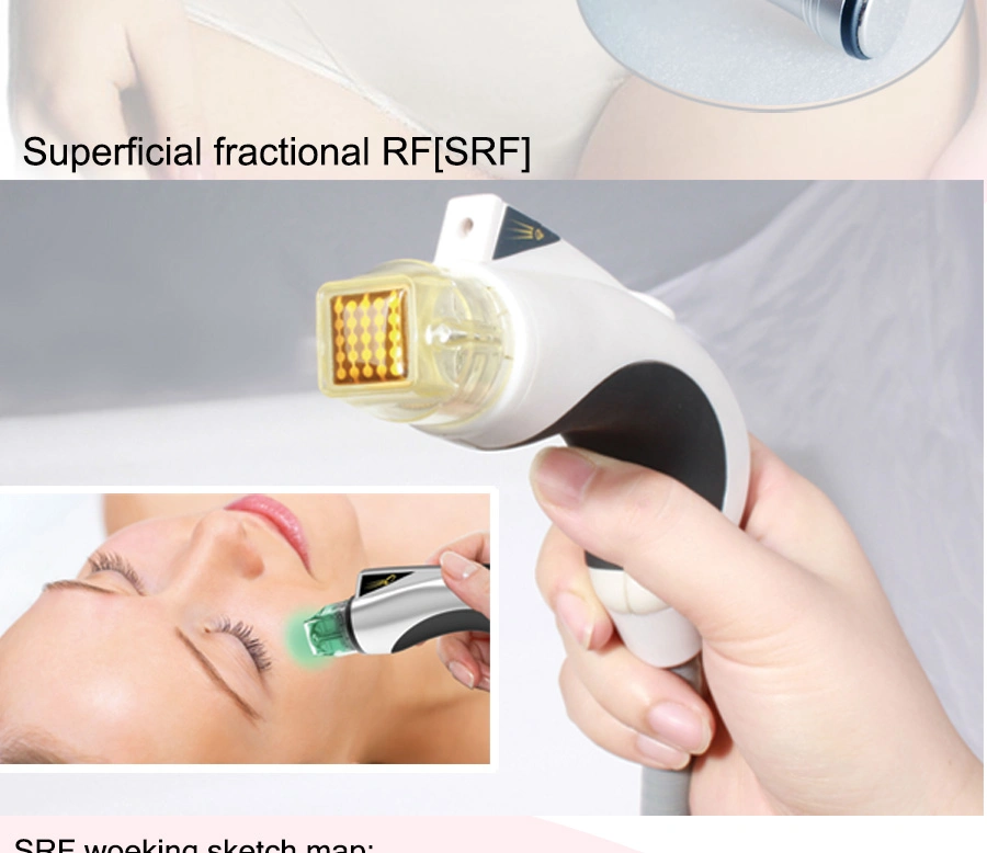 Mr18-2s Changeable 3 Sizes Fractional RF Microneedle Machine for Pore Removal