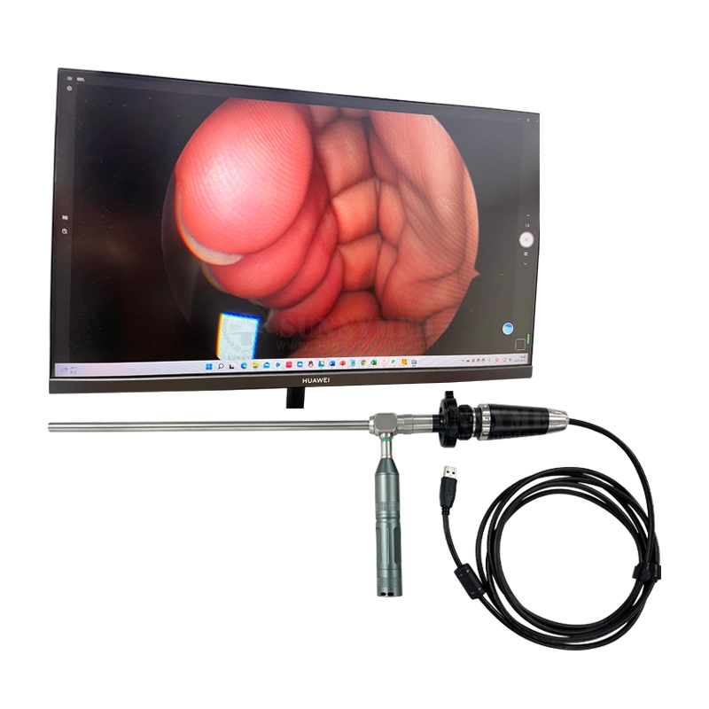 Sy-P031HD3 Fully HD Potable Medical Equipment HD USB Endoscope Camera with USB Supporting Home TV