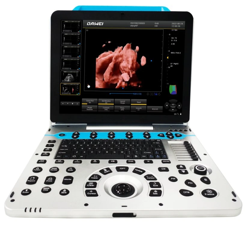 Dawei Dw-P30 Portable Abdominal Echography Doppler Color 3D 4D Ultrasound Echo Machine