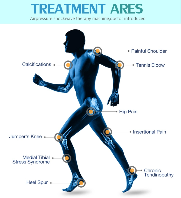 Novedades Extracorporeal Shockwave Therapy Machine alivio neumático del dolor de rodilla Aparato para tratar el dolor para la de