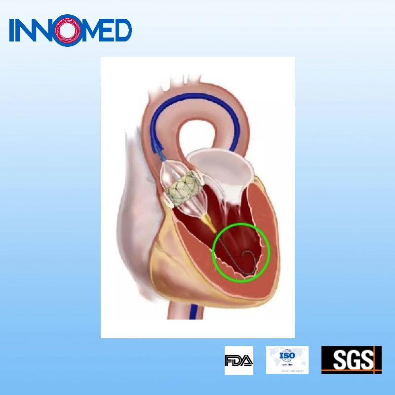 Nickeltitanium Wire Core Coronary Guidewire for Establishing Intravascular Access