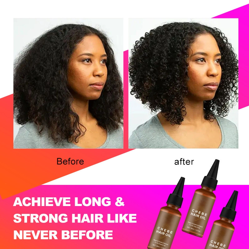 Aixin Private Label Anti Haarausfall Verdickung Reparatur Nährende Conditioner Haar Chebes Pulver Haarwachstum Serum Chebes Öl