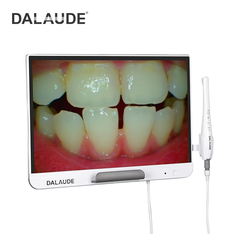 2022 Nice Monitor Intra Oral Camera Images&Video Wireless Transmission in Dentistry