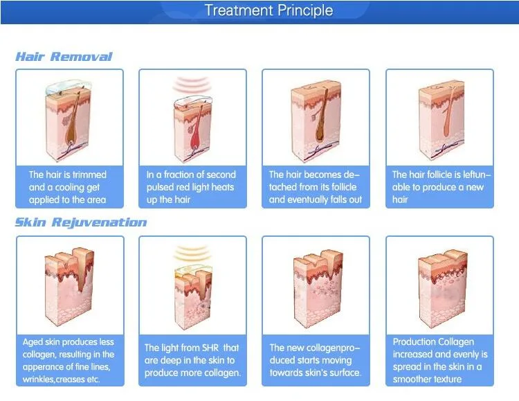 Professional Device Diode IPL Elight Laser Hair Removal Beauty Equipment