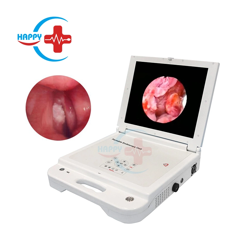 Hc-I040c Top Quality 17 Inch Big Screen LED Light Source Portable Rigid Ent Endoscope Camera