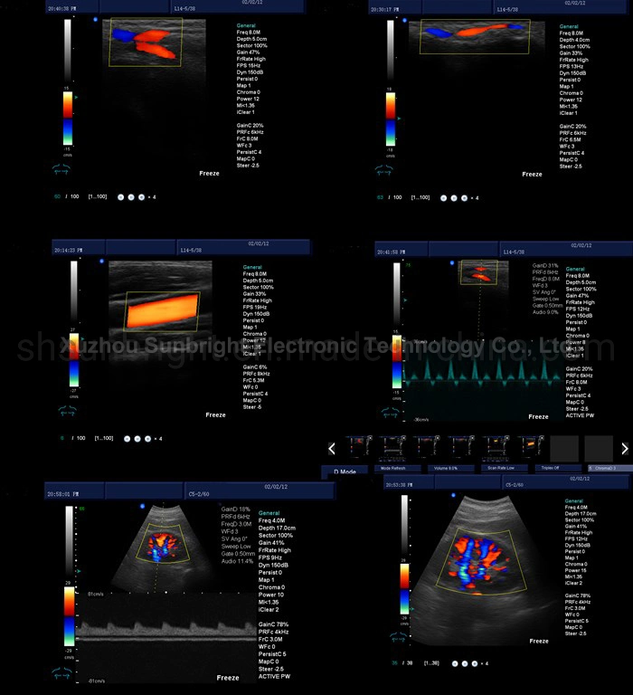 Full Digital Pregnancy Use 4D Trolley Color Doppler Ultrasound Machine Price