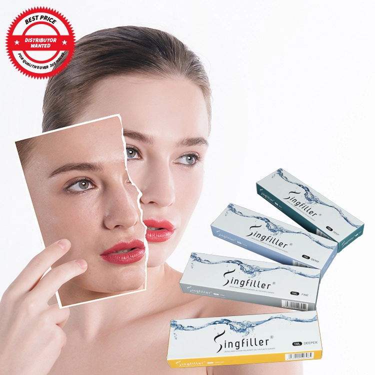 Singfiller Cross-Linked Sodium hyaluronate gel pour la chirurgie plastique de remplissage dermique