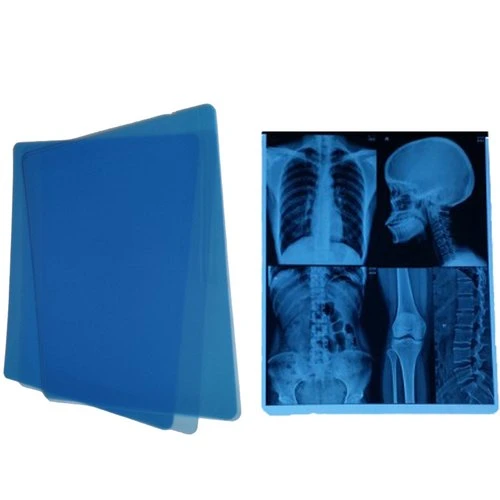 Utilisation de l'imprimante de l'hôpital médical sec radioactifs Blue Film d'impression thermique