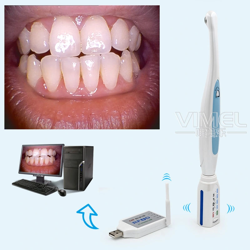 WiFi Dental Endoscope Wireless Dental Oral Cameras