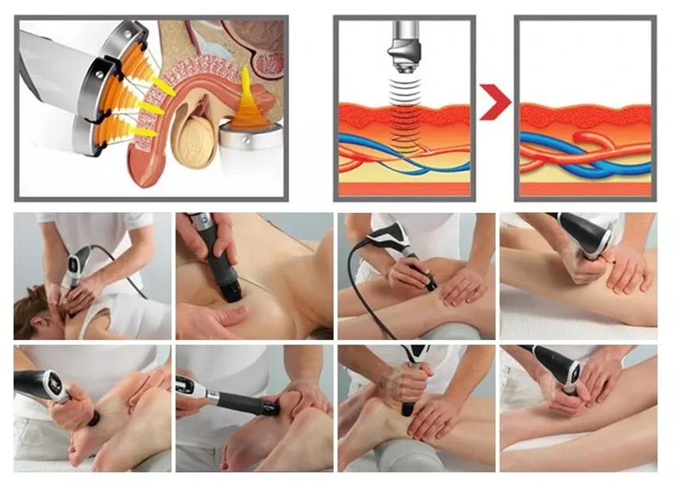 Safe and Painless Shockwave Body Equipment for All Skin Types Beauty Machine