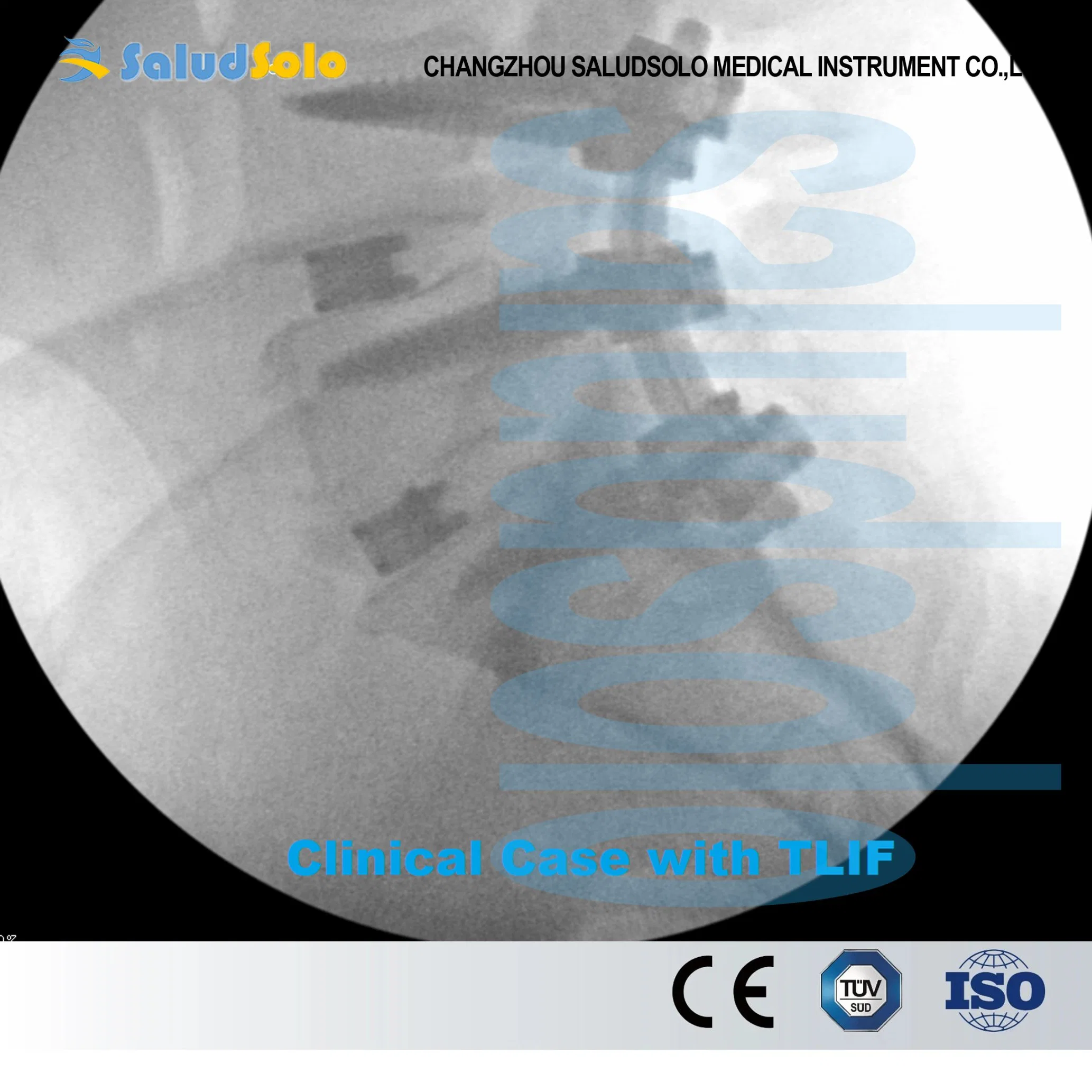 Transforaminal Lumbar Intervertebral Fusion (TLIF) Cage System, Peek Orthopedic Implant for Spine Surgery, CE&ISO Certified