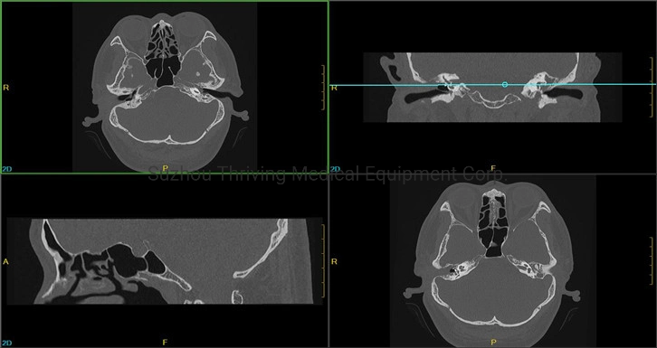 Medical Radiology Equipment CT Scan Machine Intelligent CT X-ray Scanner Machine 32 Slices