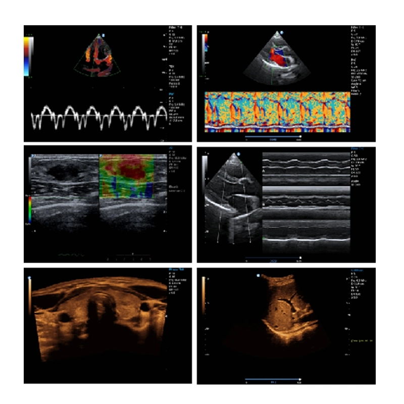 Laptop/Portable/Trolley Ultrasound Scanner Supplier Laptop Color Doppler Ultrasound Machine with 21.5" Inch LED Monitor