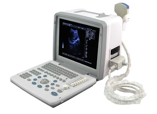 Portable Black and White Ultrasound Scanner; 2D Ultrasound Scanner; Portable Ultrasound Scanner